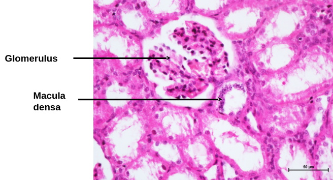JG Complex 2